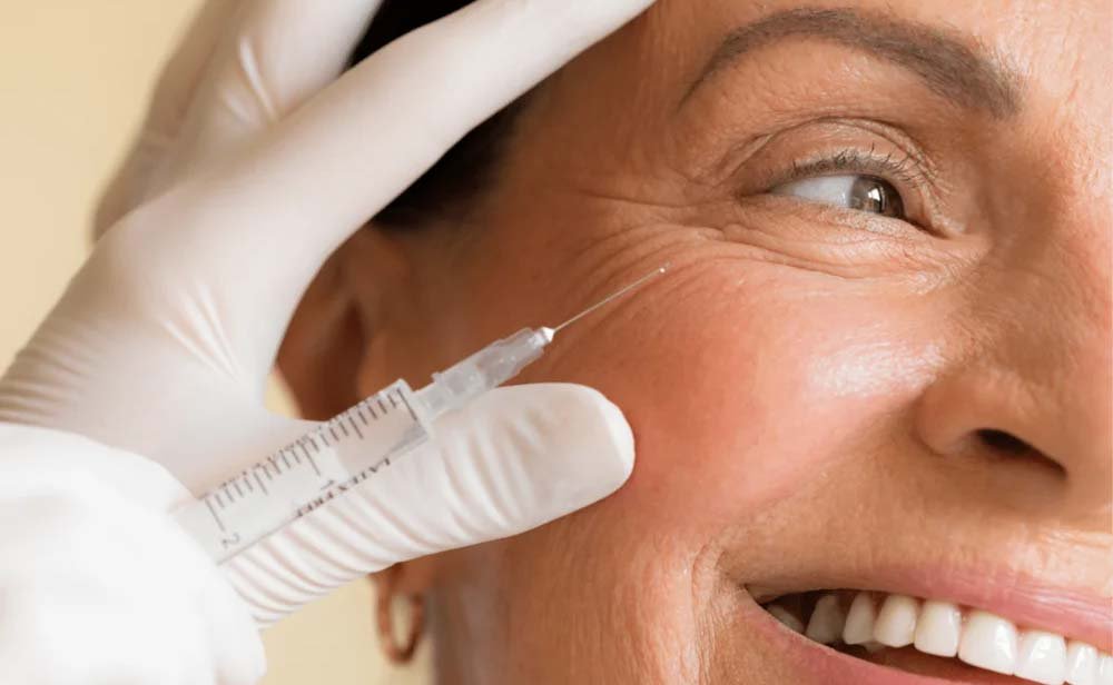 Botox: rejuvenescimento com naturalidade