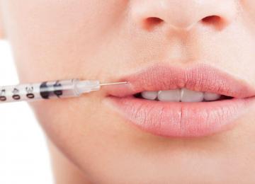 Preenchimento Labial: uma beleza com naturalidade