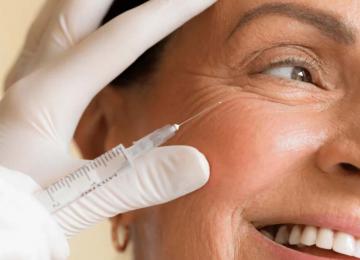 Botox: rejuvenescimento com naturalidade